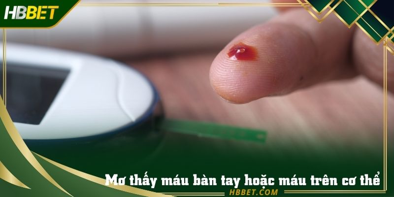 Chiêm bao thấy máu trên bàn tay thì hãy nghỉ ngơi